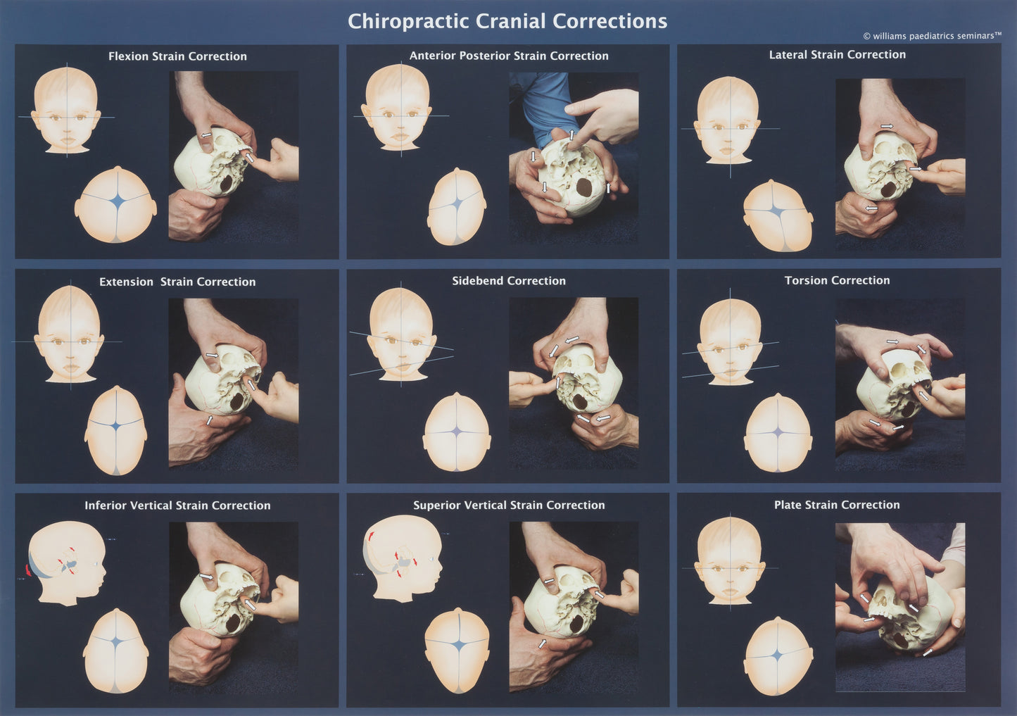 Cranial Corrections Poster